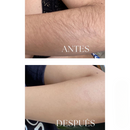 Silkvia™ – Depilación IPL Profesional desde Casa