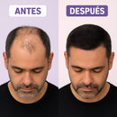 EfectoDenso™ RELLENO CAPILAR INSTANTANEO - OFERTA 3x1