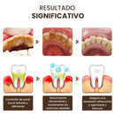 Blanqué™ – Blanqueamiento potente, sonrisa impecable