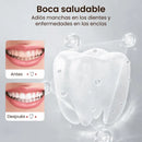 Blanqué™ – Blanqueamiento potente, sonrisa impecable