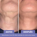 Élan – Cuello y escote más firmes, suaves y radiantes