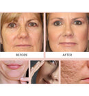 Hoygi Mascarilla Facial de Colageno + Aplicador Gratis - [PROMOCIÓN DISPONIBLE SOLO HOY]