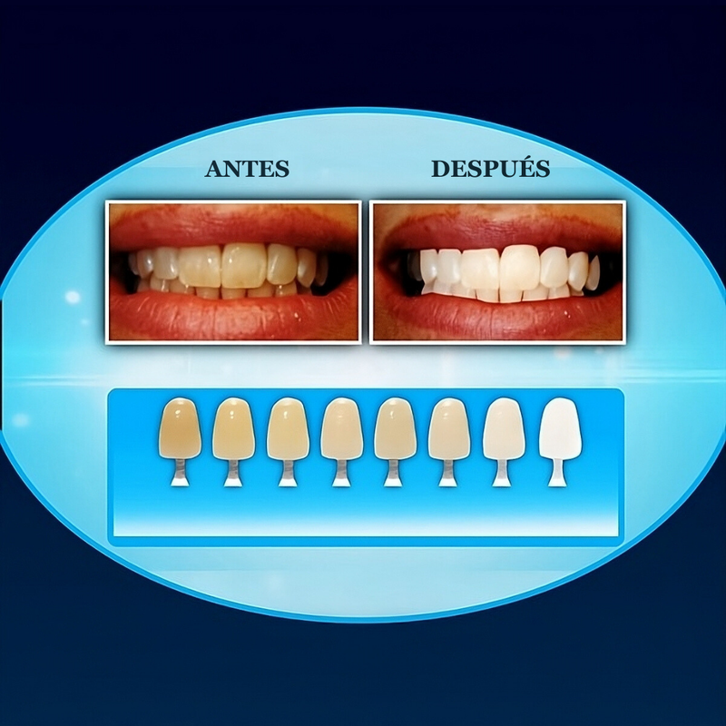 LumiSmile™  Kit Blanqueador Dental UV - [PROMOCIÓN DISPONIBLE SOLO HOY]