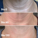 Élan – Cuello y escote más firmes, suaves y radiantes