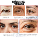 OUHOE SERUM QUITA OJERAS - [PROMOCIÓN DISPONIBLE SOLO HOY]