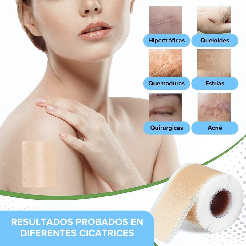 Siliscar™ CINTA PARA CICATRICES QUELOIDES - [PROMOCIÓN DISPONIBLE SOLO HOY]