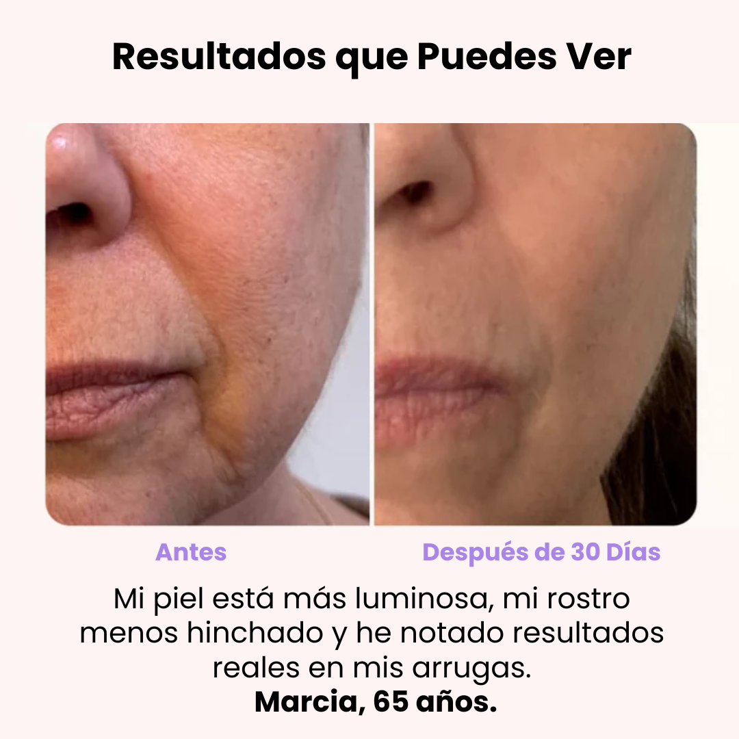 DermaGlow 4D -  Masajeador Reductor de Arrugas - [PROMOCIÓN DISPONIBLE SOLO HOY]