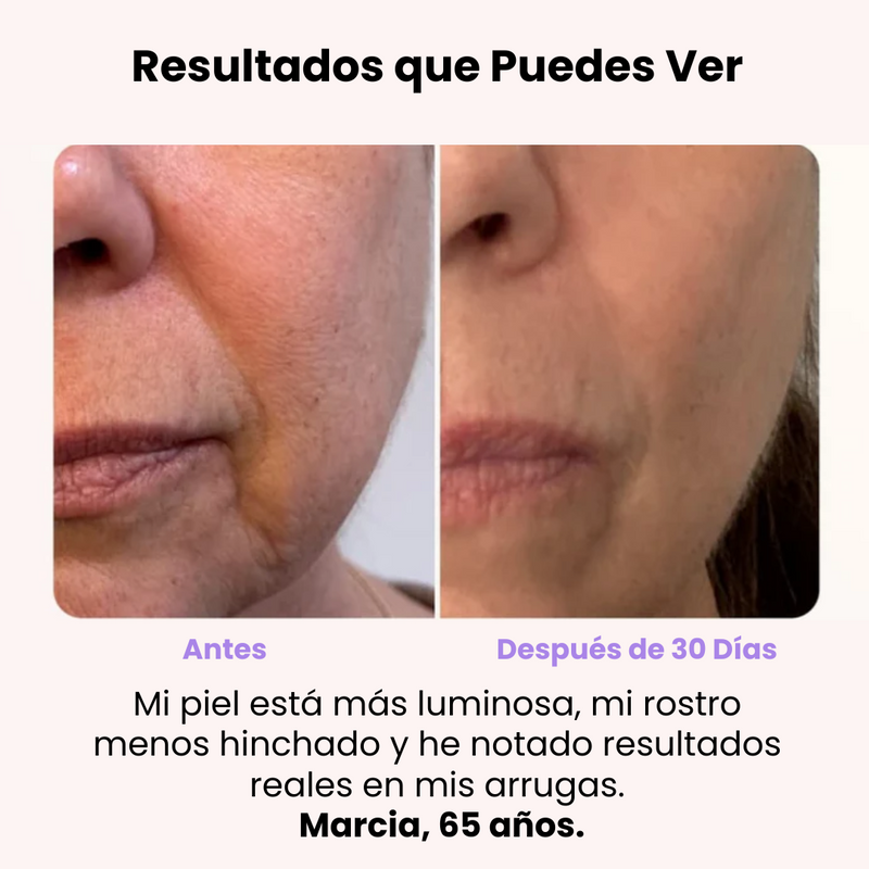 DermaGlow 4D™ -  Masajeador Reductor de Arrugas - [PROMOCIÓN DISPONIBLE SOLO HOY]