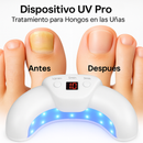 Dispositivo UV Pro – Tratamiento Avanzado para el Cuidado de Uñas