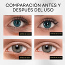 OUHOE SERUM QUITA OJERAS - [PROMOCIÓN DISPONIBLE SOLO HOY]