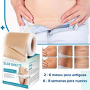 Siliscar CINTA PARA CICATRICES QUELOIDES - [PROMOCIÓN DISPONIBLE SOLO HOY]