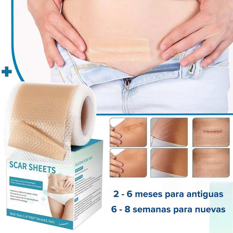 Siliscar™ CINTA PARA CICATRICES QUELOIDES - [PROMOCIÓN DISPONIBLE SOLO HOY]