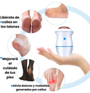 REMOVEDOR DE CALLOS - [PROMOCIÓN DISPONIBLE SOLO HOY]