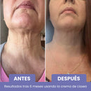 Élan – Cuello y escote más firmes, suaves y radiantes