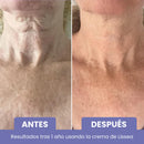 Élan – Cuello y escote más firmes, suaves y radiantes