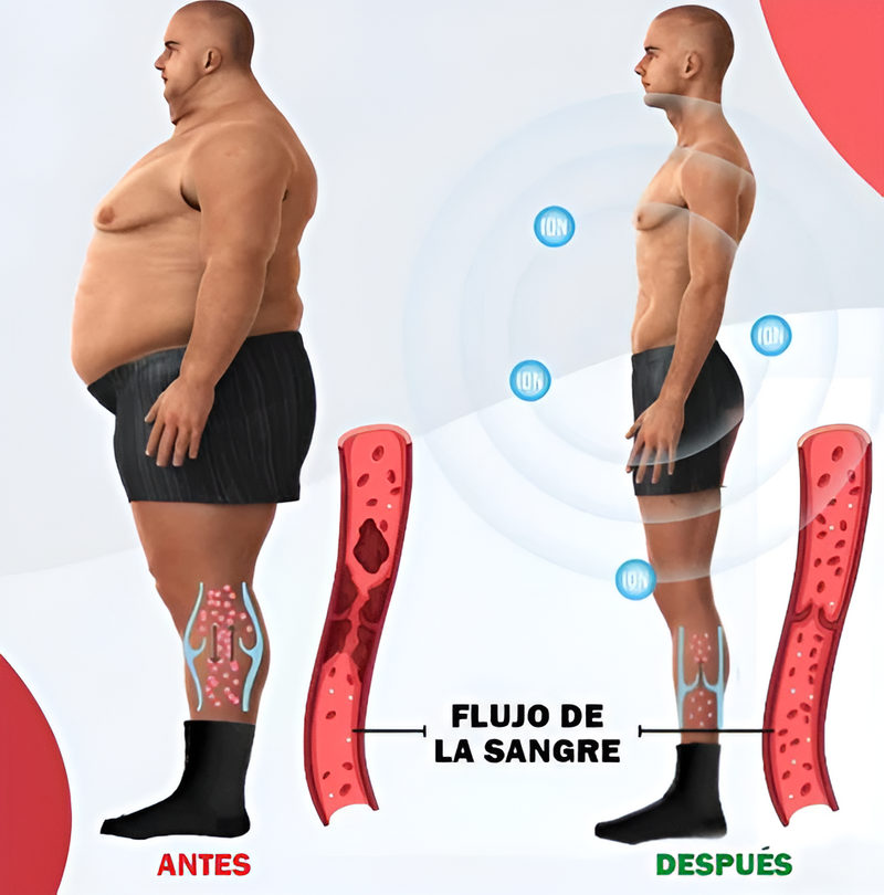 Anti-Varices™  Calcetines Autocalentables -  [PROMOCIÓN DISPONIBLE SOLO HOY]