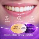 UltraWhite V34 – Ilumina Tu Sonrisa