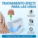 OnyLight - Dispositivo Láser para Cuidado de Uñas