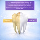 UltraWhite V34 – Ilumina Tu Sonrisa