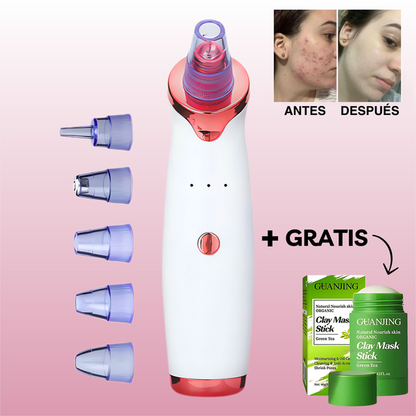 Pure Skin™ Limpiador de Puntos Negros + Green Mask Stick™ Mascarilla Té Verde GRATIS - [PROMOCIÓN DISPONIBLE SOLO HOY]