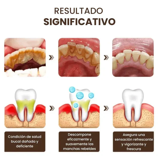 Blanqué™ – Blanqueamiento potente, sonrisa impecable