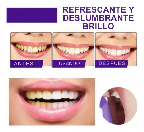 SmilePro Instant™ - Dientes Blancos sin Dentista