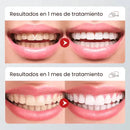 Blanqué – Blanqueamiento potente, sonrisa impecable