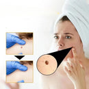 Recede Verrugas Fuera, Piel Limpia