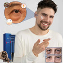 VezeSkin™ Crema Poderosa para Ojeras y Arrugas Profundas - [PROMOCIÓN DISPONIBLE SOLO HOY]