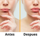 Lipomagic Aumentador de labios - [PROMOCIÓN DISPONIBLE SOLO HOY]