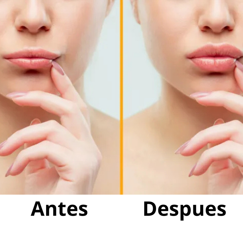 Lipomagic™ Aumentador de labios - [PROMOCIÓN DISPONIBLE SOLO HOY]